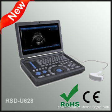 2015 Laptop Full Digital Ultrasonic Diagnostic System
